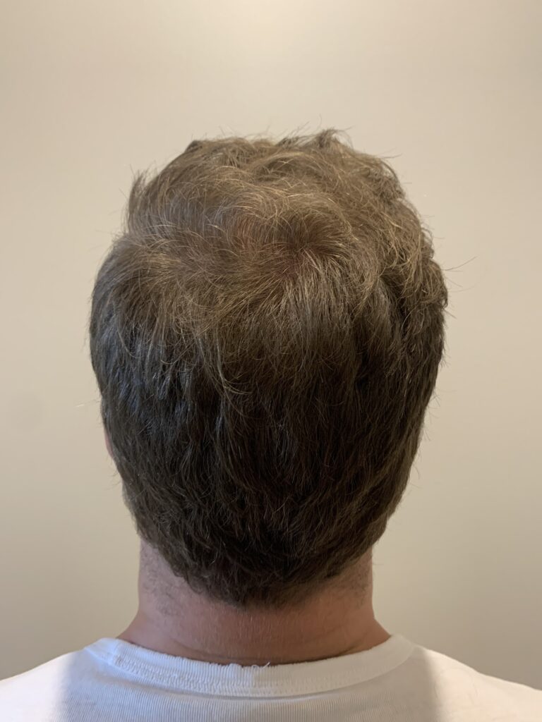 Elite Hair Clinic gallery photo