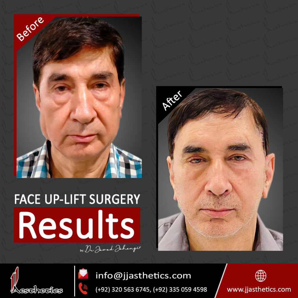 JJ Aesthetics | Hair Transplant in Islamabad | Plastic Surgery | Exosome in Islamabad gallery photo