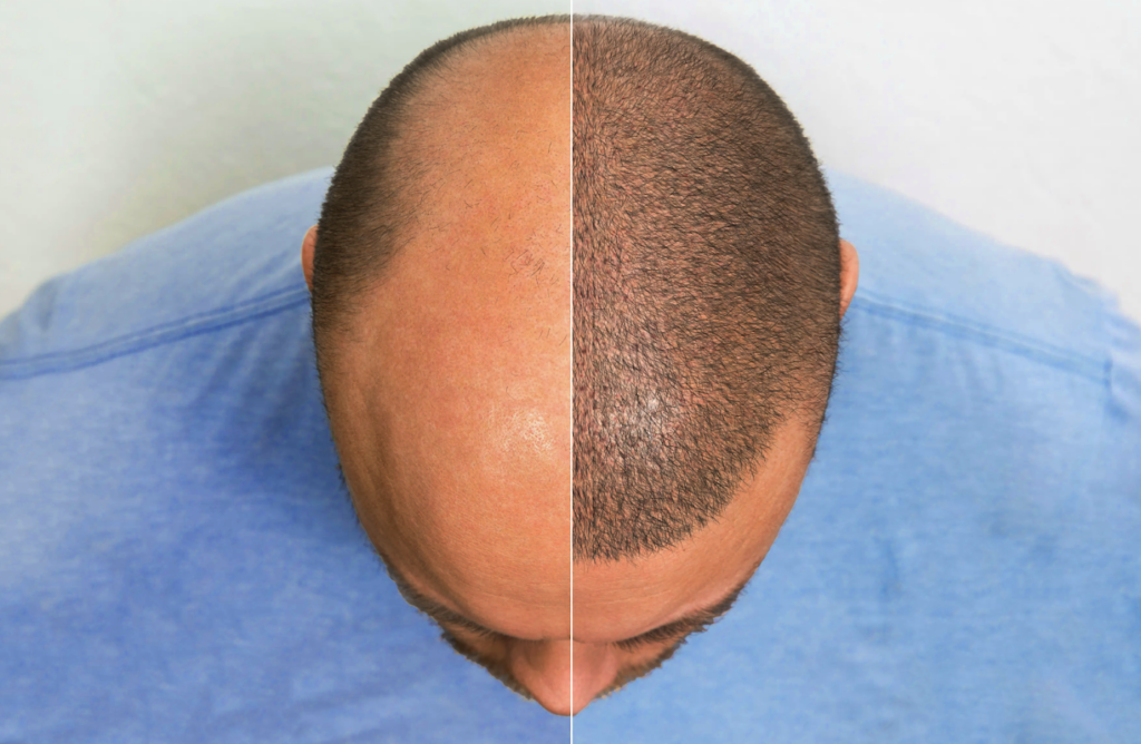 The Hair Restoration & Transplant Clinic gallery photo