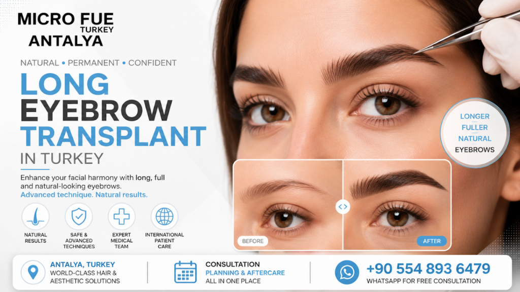 Hair Transplant Antalya gallery photo