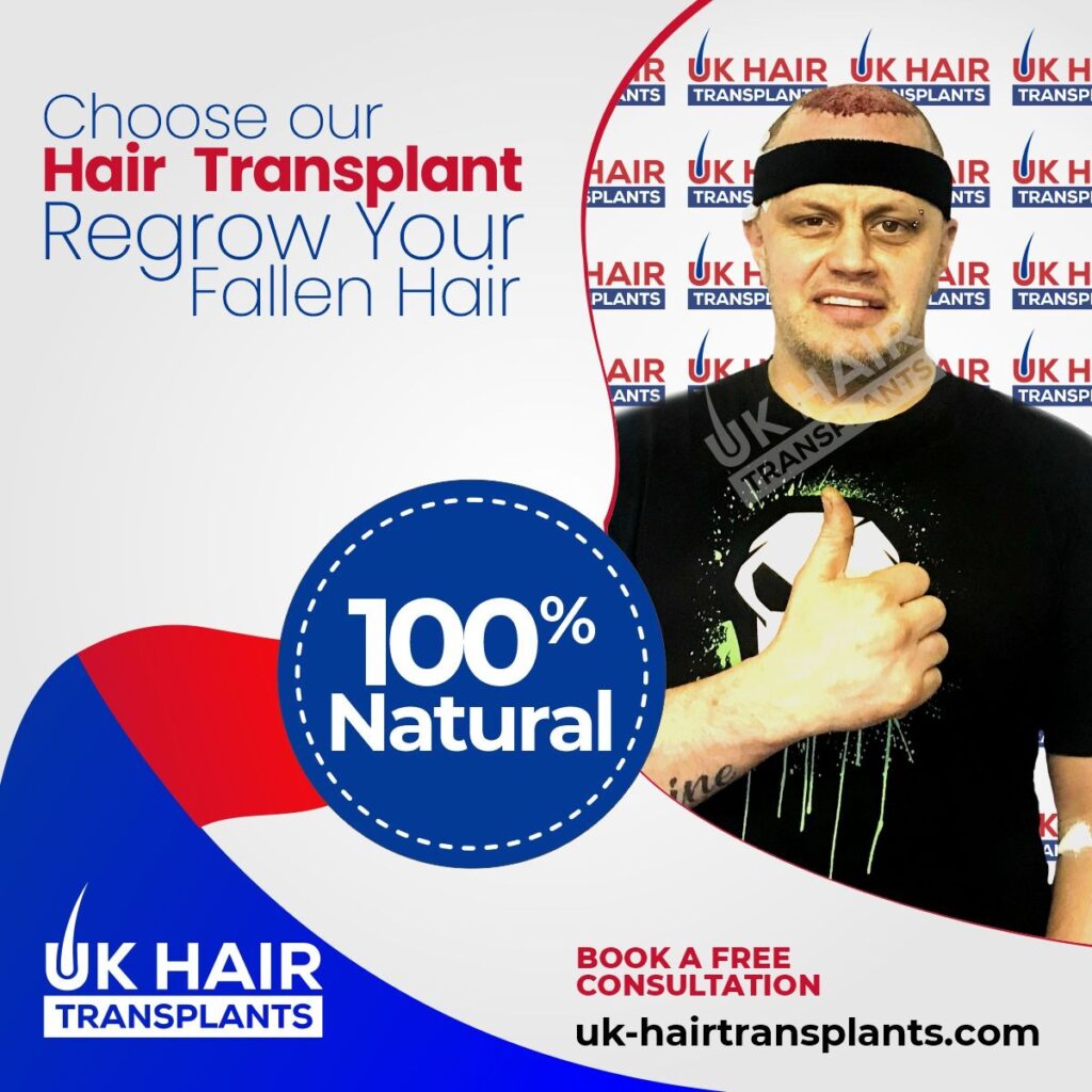 UK Hair Transplants UKHT Birmingham gallery photo