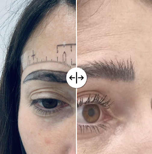 Wimpole Hair Transplant Clinic Nottingham gallery photo