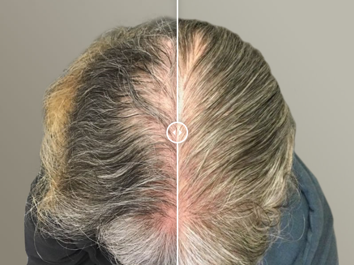 MassDerm Hair Transplant Institute gallery photo