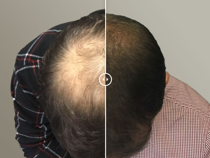 MassDerm Hair Transplant Institute gallery photo