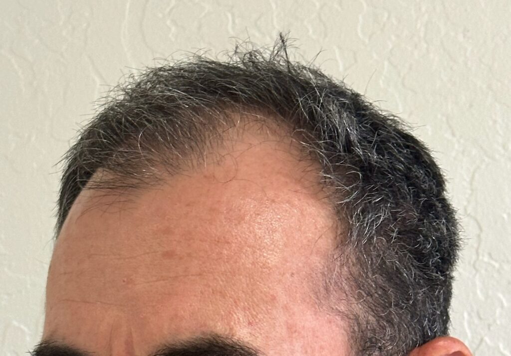 Hair 4 Life Medical gallery photo