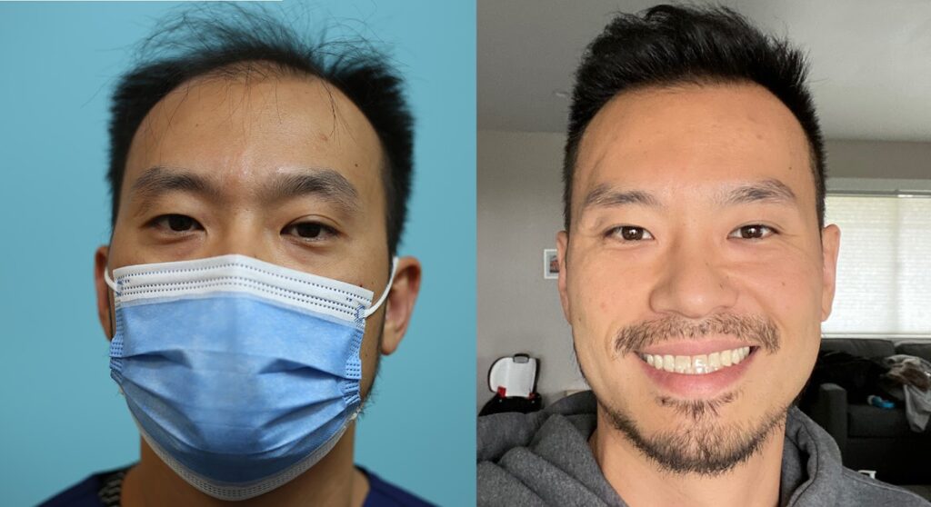 California Hair Surgeon gallery photo