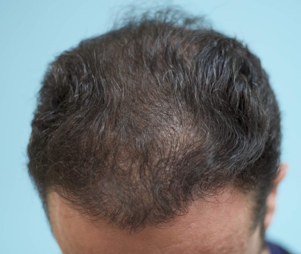 California Hair Surgeon gallery photo