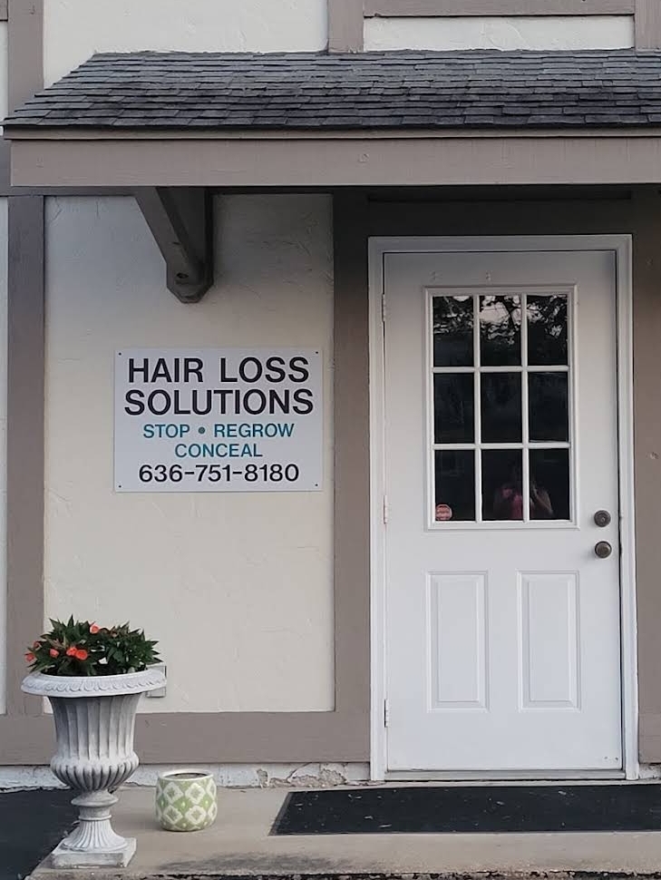 Hair Loss Solutions gallery photo