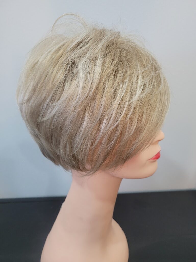 Hair Loss Solutions gallery photo