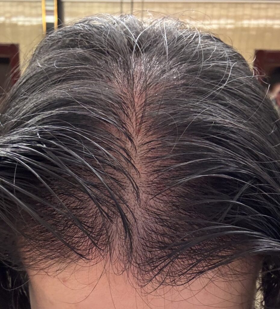 Hair and Skin Science Sydney CBD gallery photo