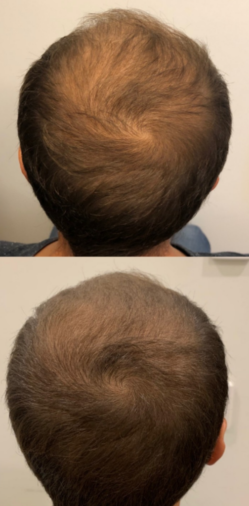 Hair and Skin Science Sydney CBD gallery photo
