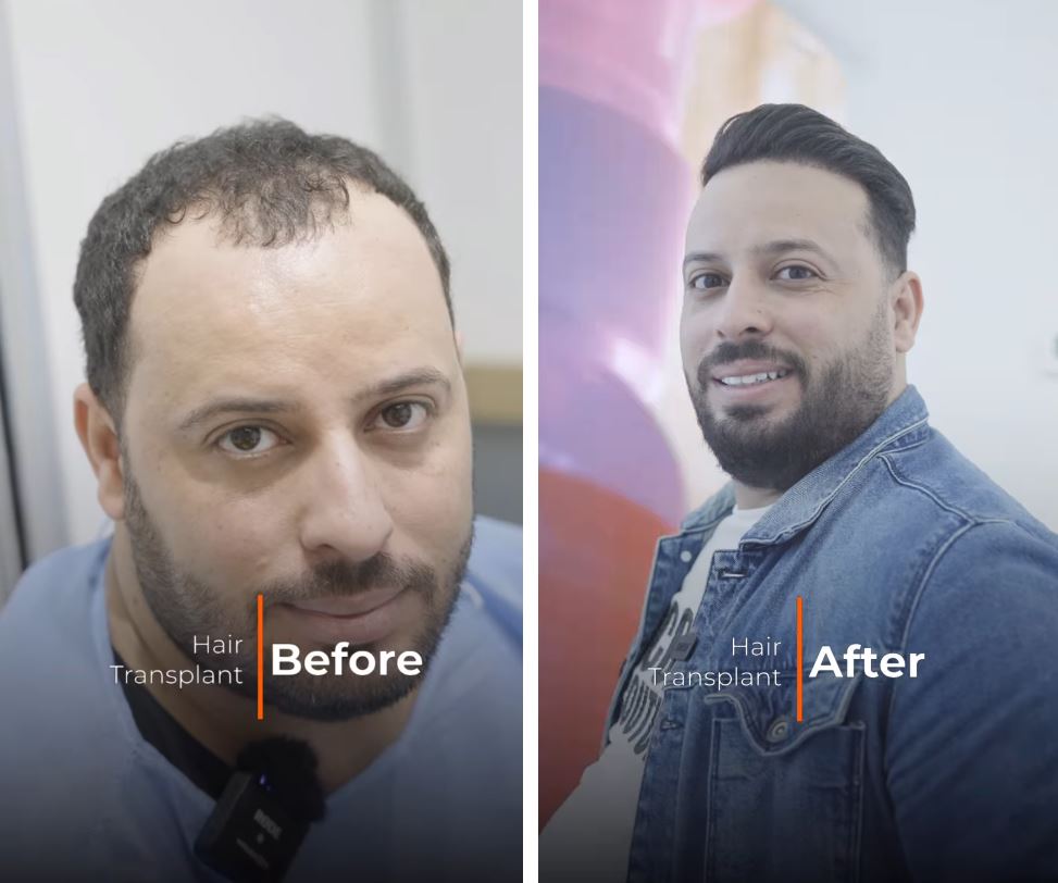 Padra Clinic – Hair Transplant & Aesthetics gallery photo