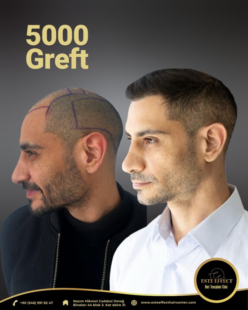 Este Effect Hair Clinic – Lefkoşa gallery photo