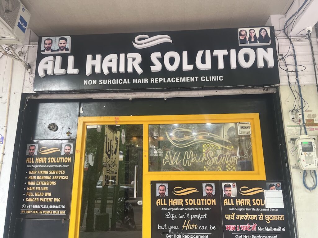 All Hair Solution Agra | Best Hair Patch and Wigs services in Agra| Best Hair Bonding Service in Agra | Hair Replacement gallery photo