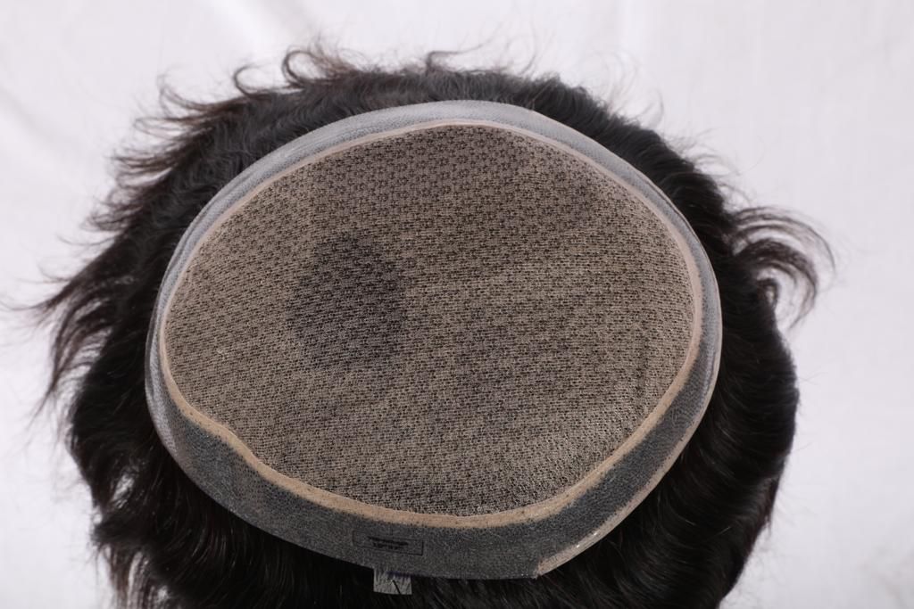 All Hair Solution Agra | Best Hair Patch and Wigs services in Agra| Best Hair Bonding Service in Agra | Hair Replacement gallery photo