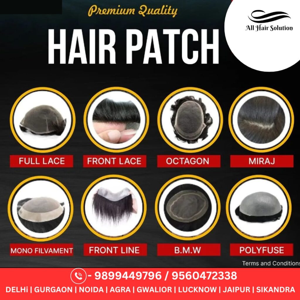 All Hair Solution Agra | Best Hair Patch and Wigs services in Agra| Best Hair Bonding Service in Agra | Hair Replacement gallery photo