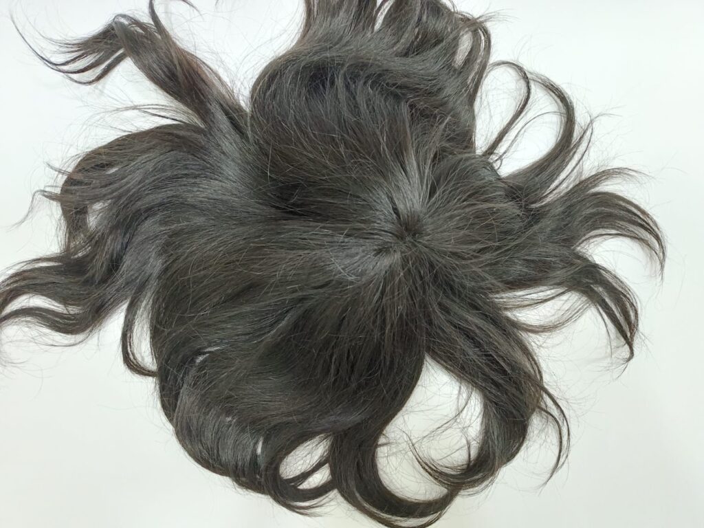 All Hair Solution Agra | Best Hair Patch and Wigs services in Agra| Best Hair Bonding Service in Agra | Hair Replacement gallery photo