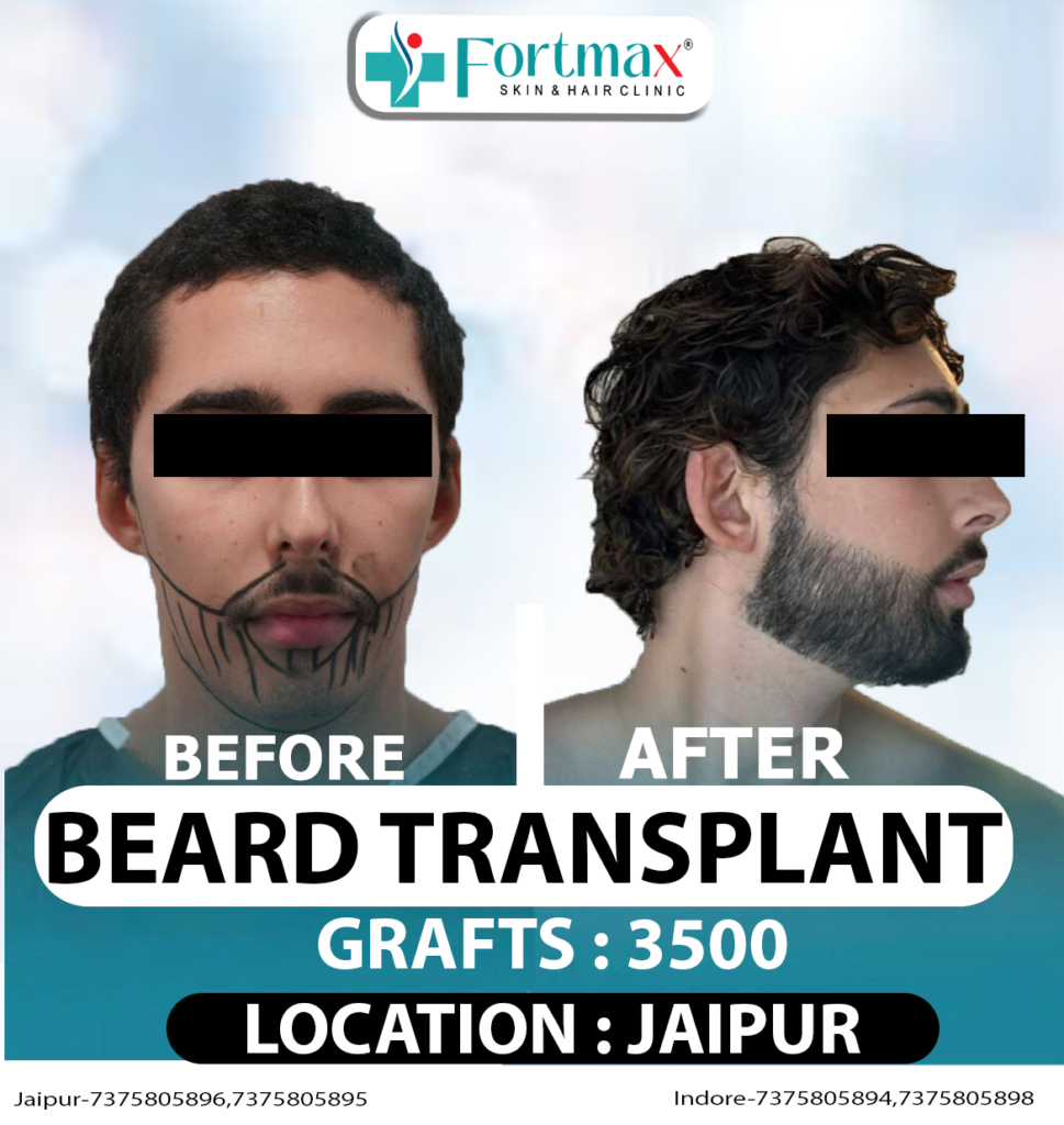 Fortmax Clinic Hair Transplant & Cosmetic Surgery in indore gallery photo