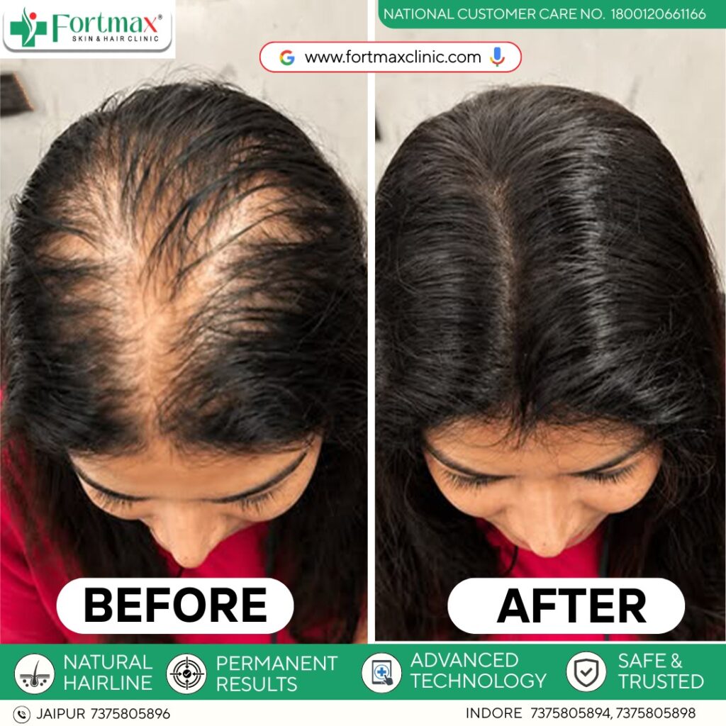 Fortmax Clinic Hair Transplant & Cosmetic Surgery in indore gallery photo
