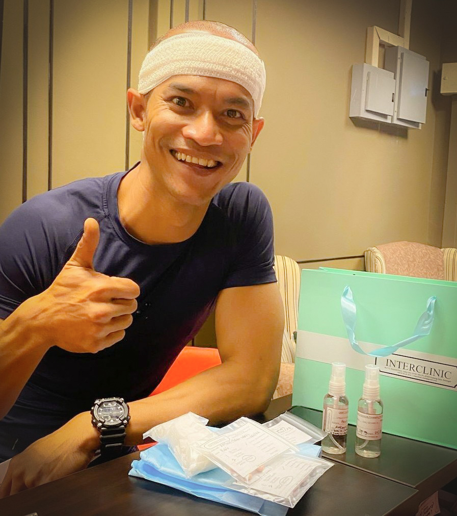 Dr Ruz Hair Transplant gallery photo