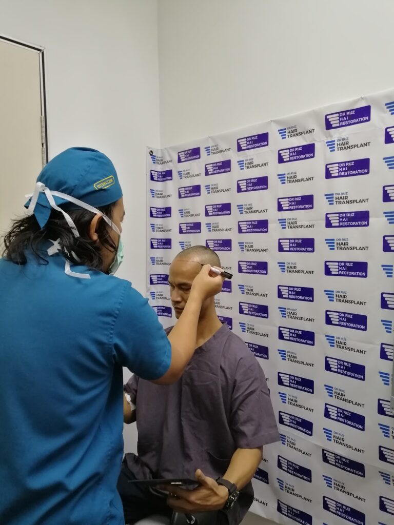 Dr Ruz Hair Transplant gallery photo