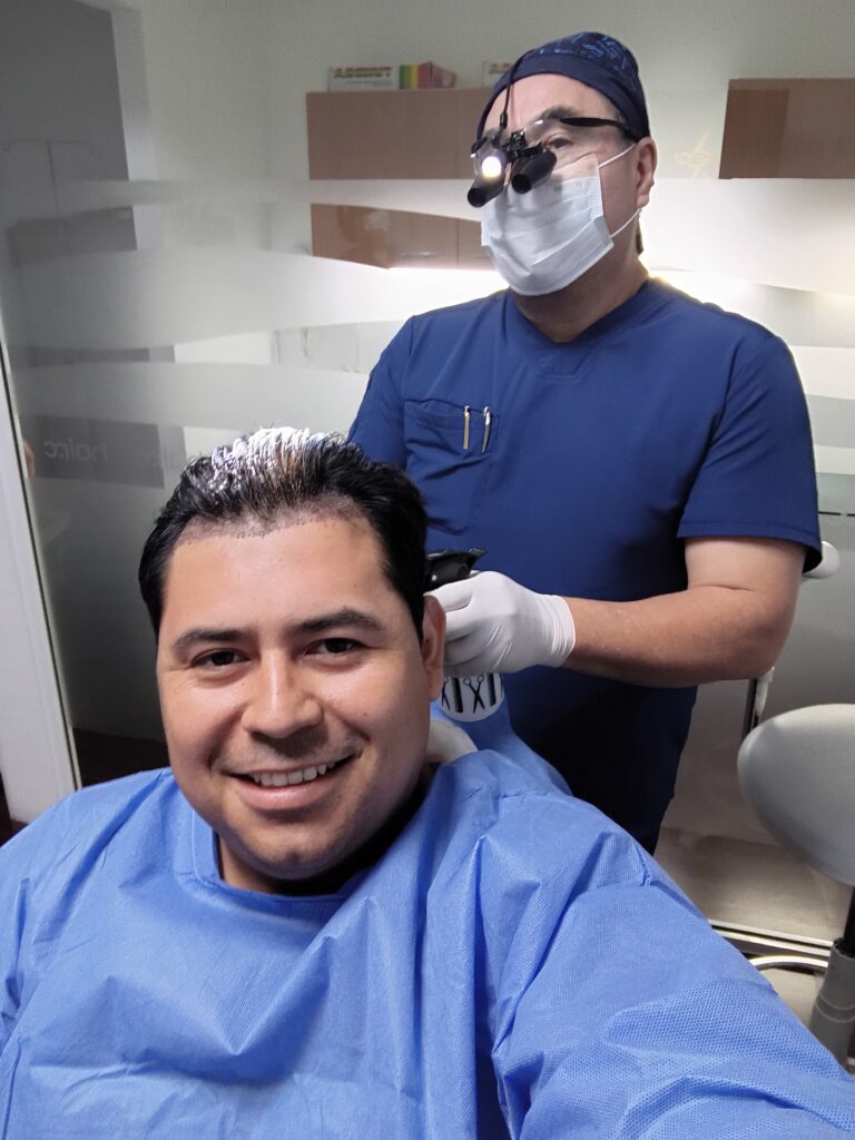 Transplante de cabello hair.c gallery photo