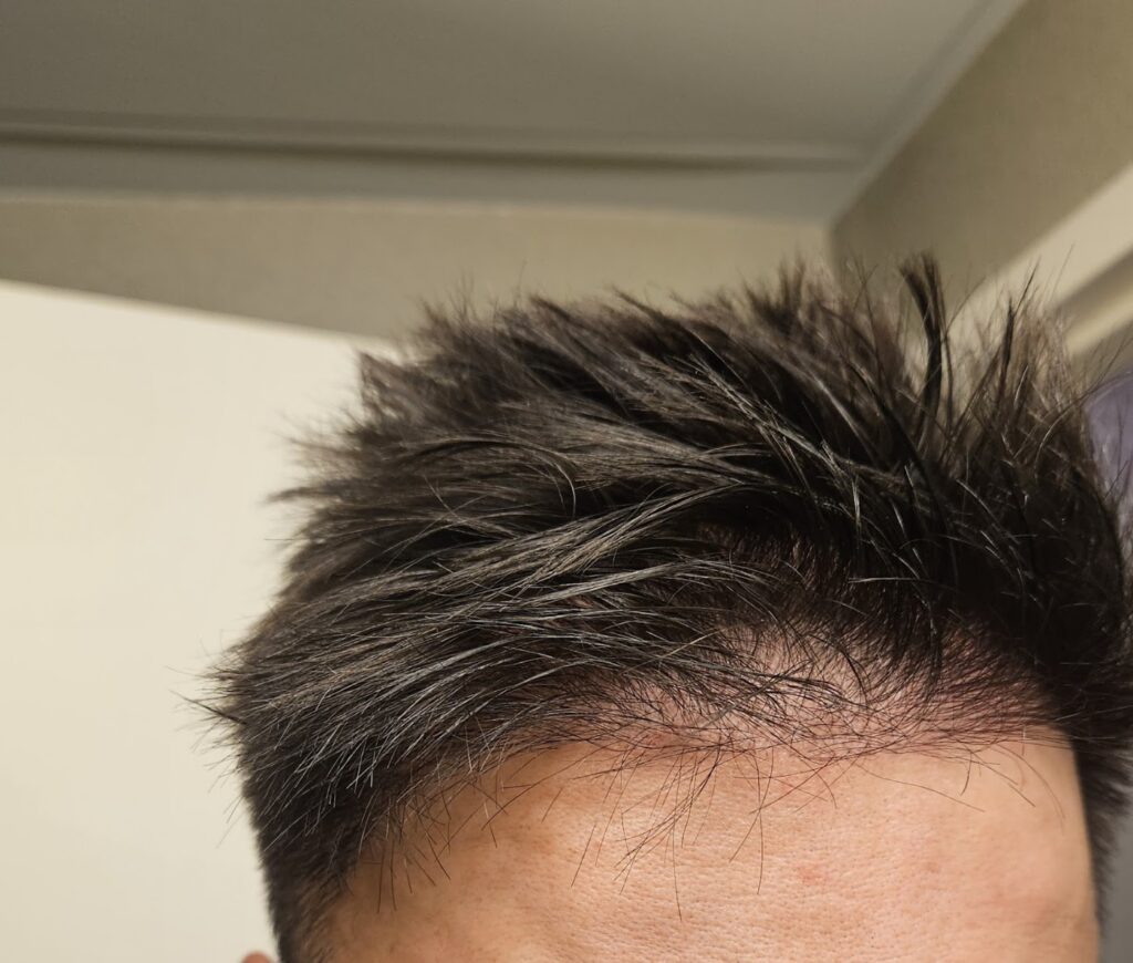 Medical Hair Madrid – Clínica Capilar gallery photo