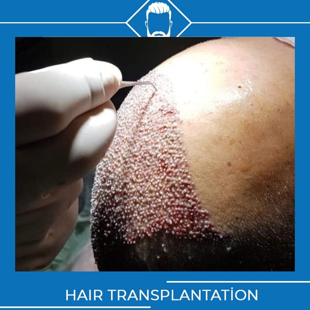 Data Hair Clinic & Eyyüp Tütüncü Saç Ekim Merkezi gallery photo