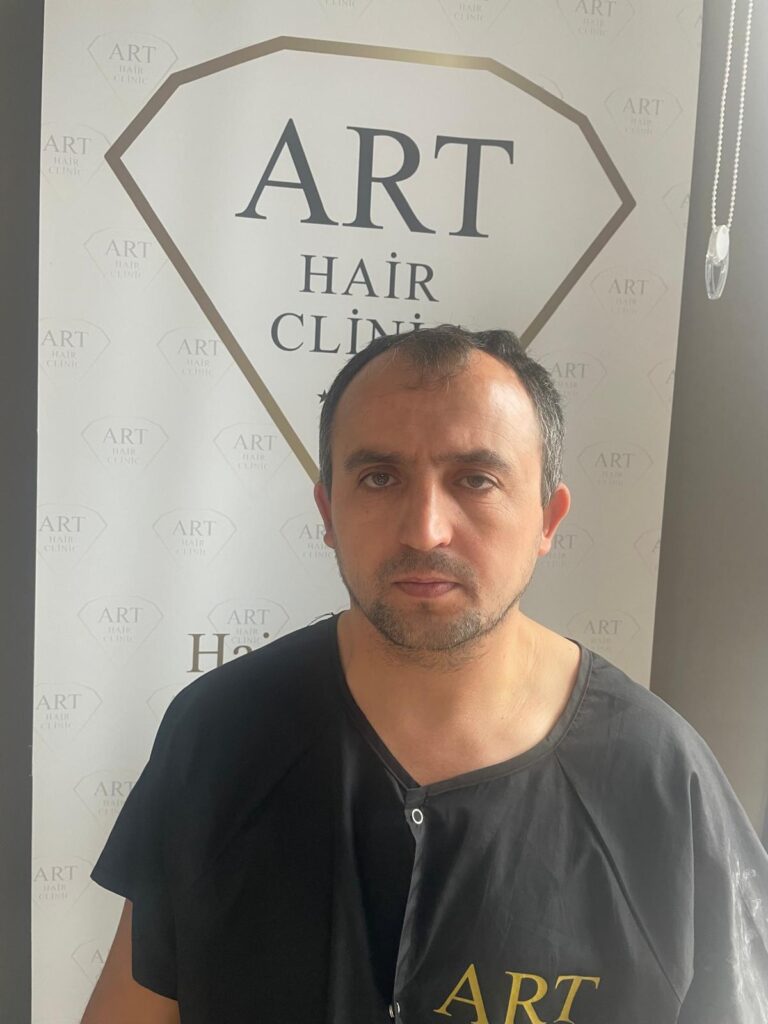 İzmir Saç Ekim Merkezi – Art Hair Clinic gallery photo