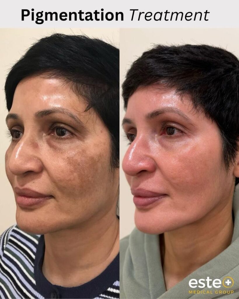 Este Medical Group: Hair and Skin Clinic in Manchester gallery photo