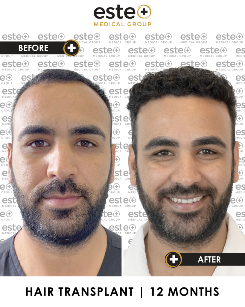 Este Medical Group: Hair and Skin Clinic in Manchester gallery photo