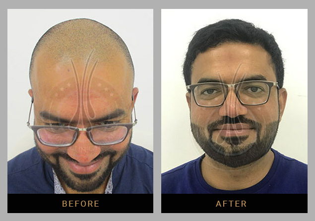 Hair Clinic Dubai gallery photo