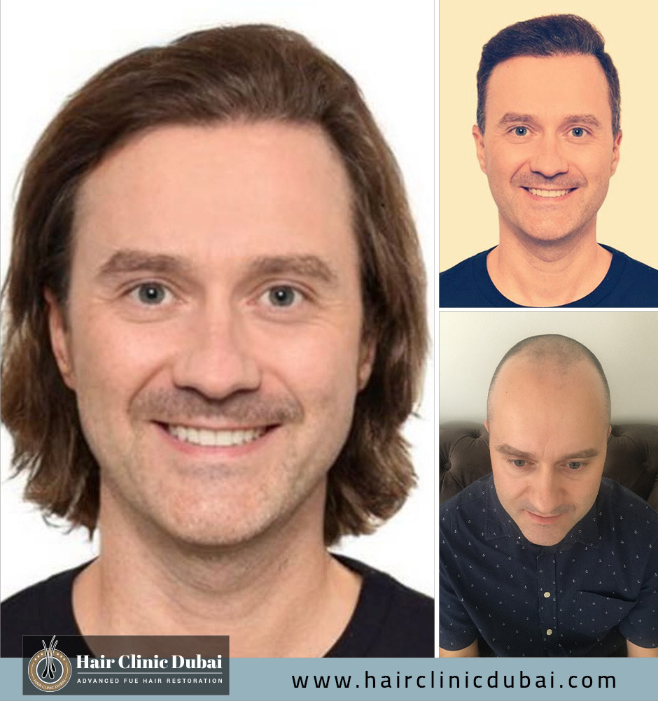 Hair Clinic Dubai gallery photo