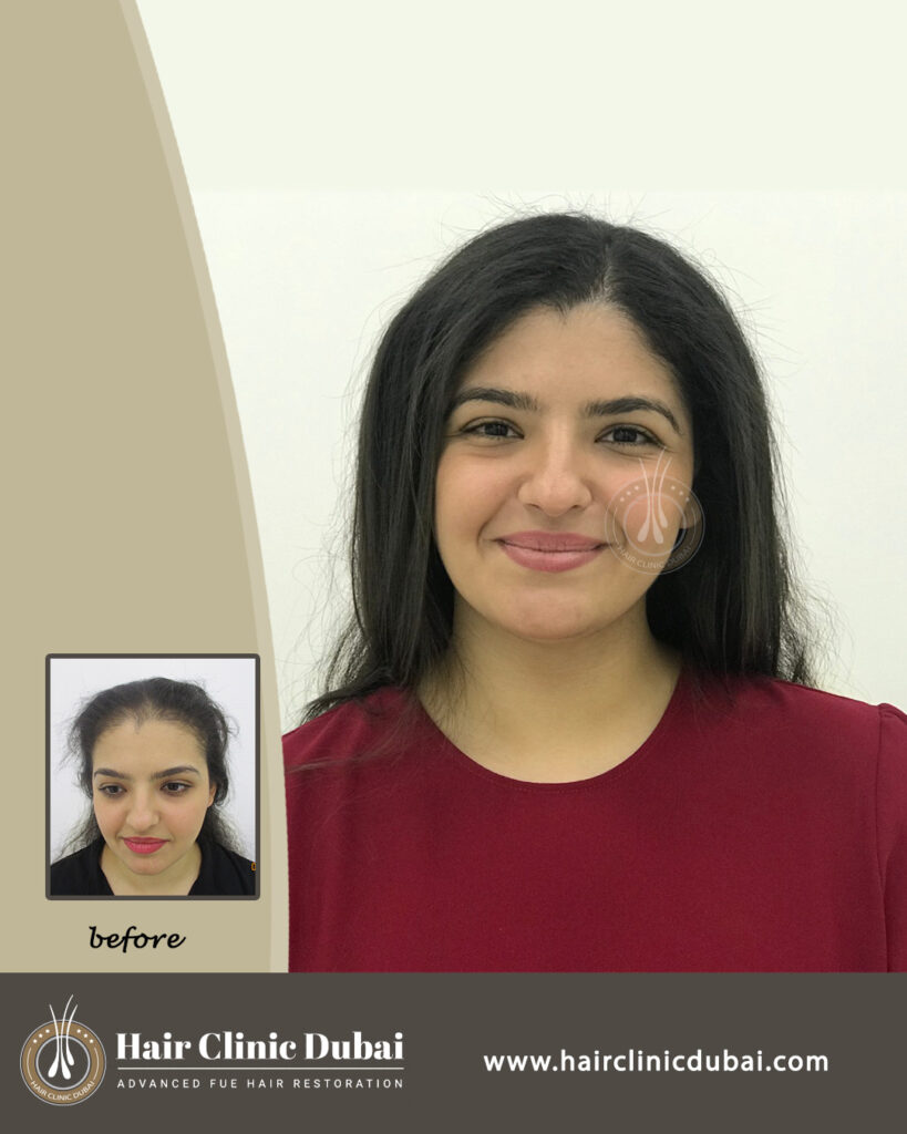 Hair Clinic Dubai gallery photo