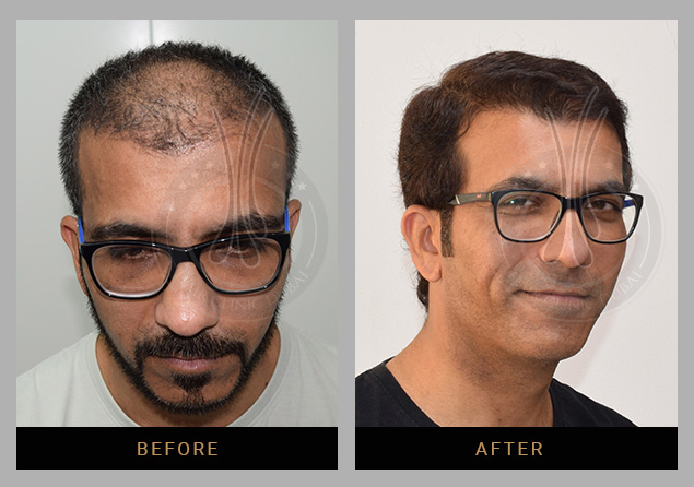 Hair Clinic Dubai gallery photo