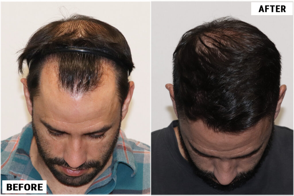 ForHair Hair Transplant Clinic gallery photo