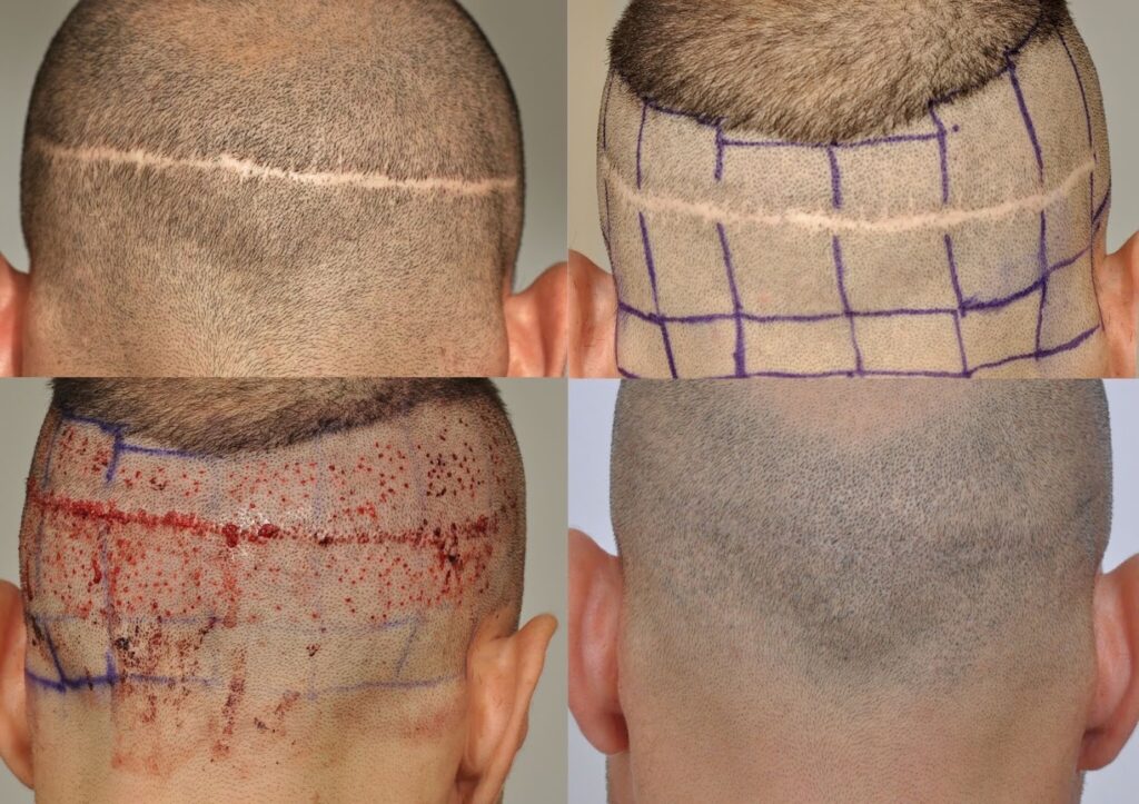 ForHair Hair Transplant Clinic gallery photo