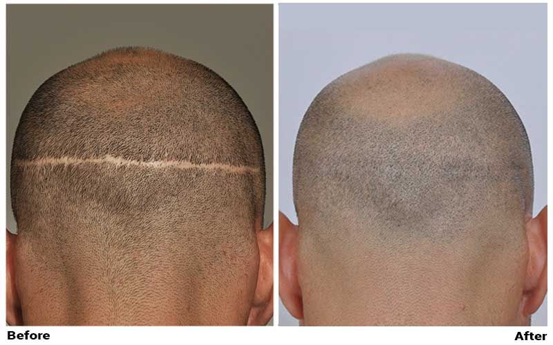 ForHair Hair Transplant Clinic gallery photo