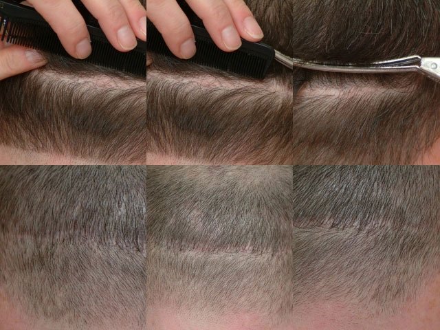 ForHair Hair Transplant Clinic gallery photo
