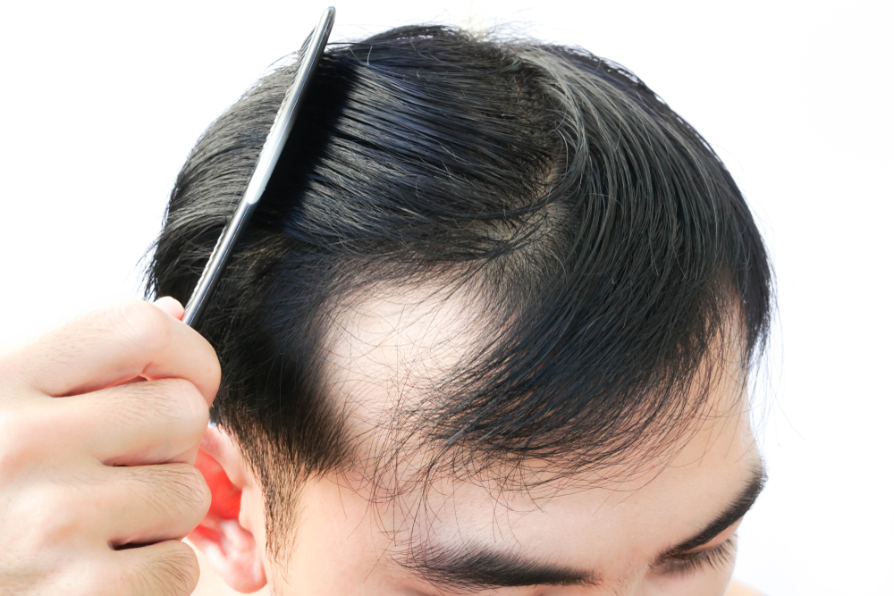ForHair Hair Transplant Clinic gallery photo
