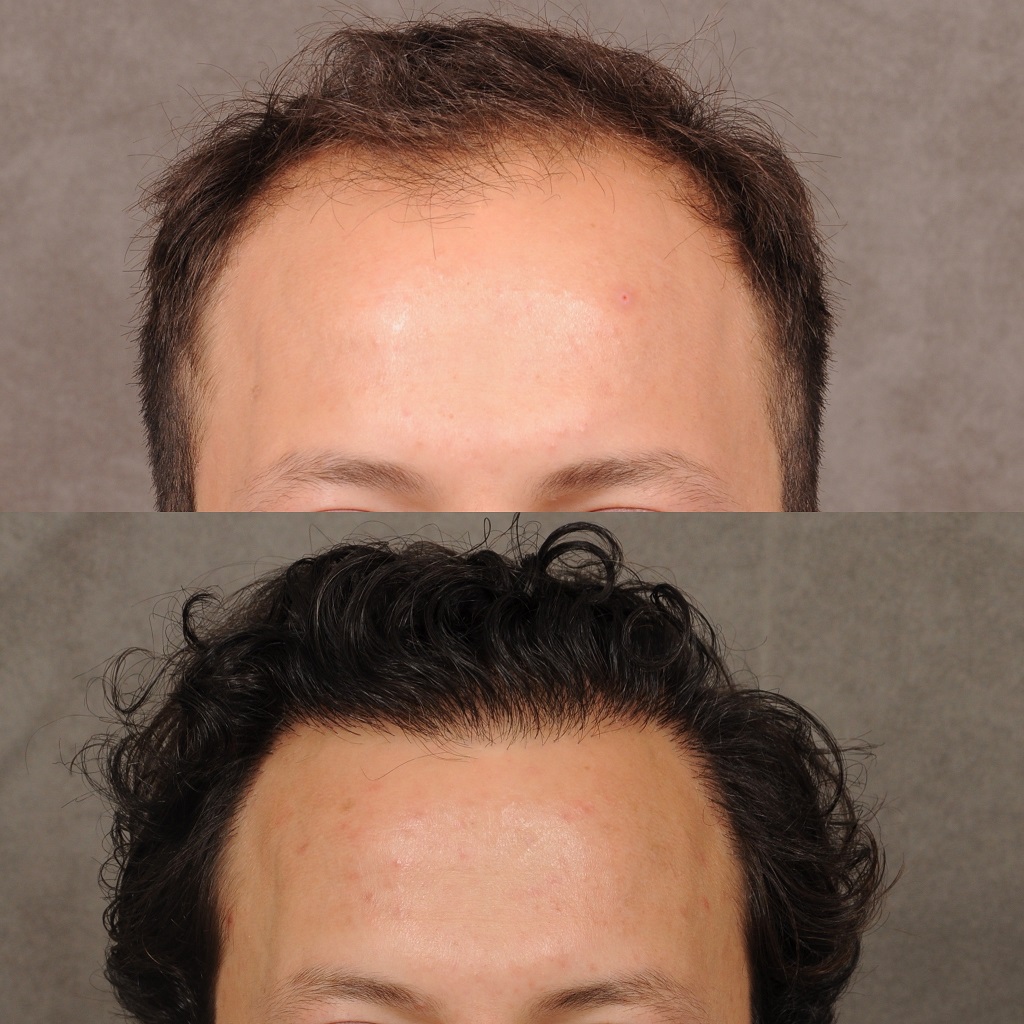 Beverly Hills Hair Group gallery photo