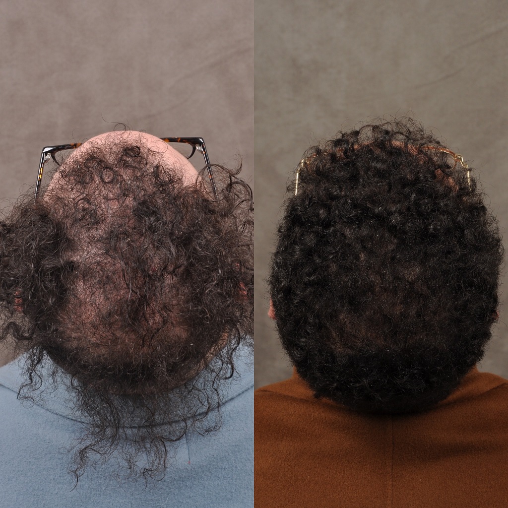 Beverly Hills Hair Group gallery photo
