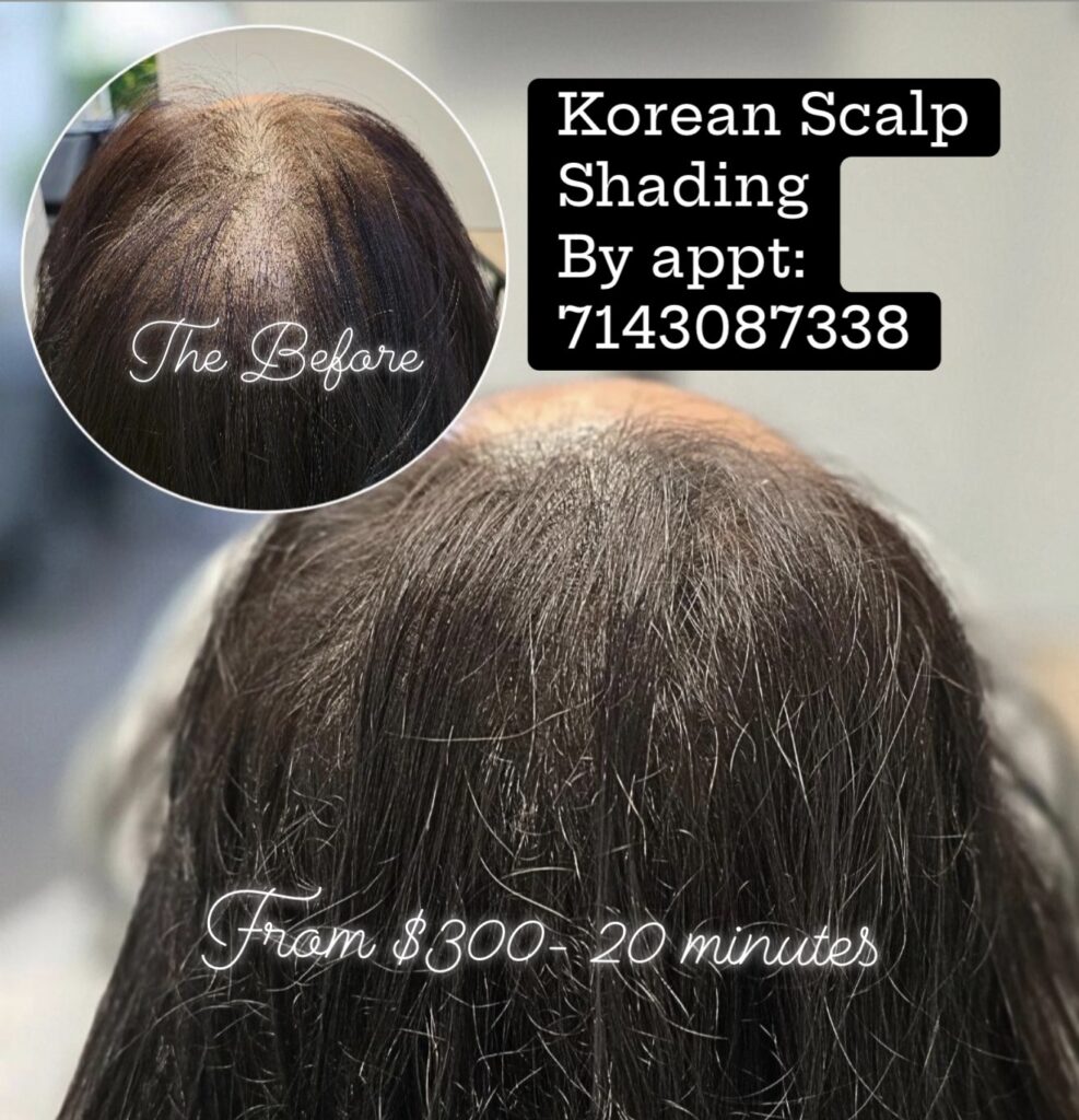 SMP Hair Clinic The Queen Of Scalp gallery photo
