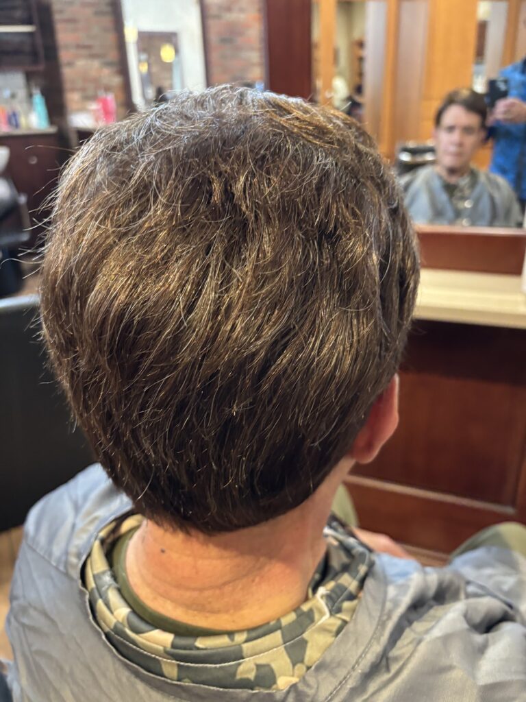 Nonsurgical Hair Replacement & Salon Services Group LLC. gallery photo