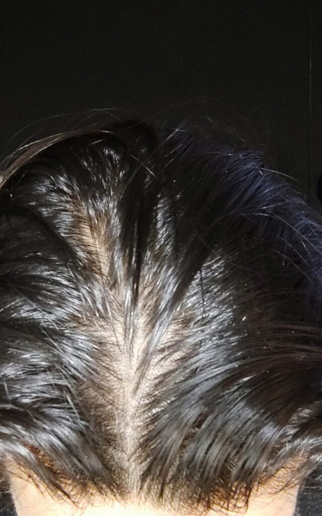 Orlando Hair Restoration Center gallery photo