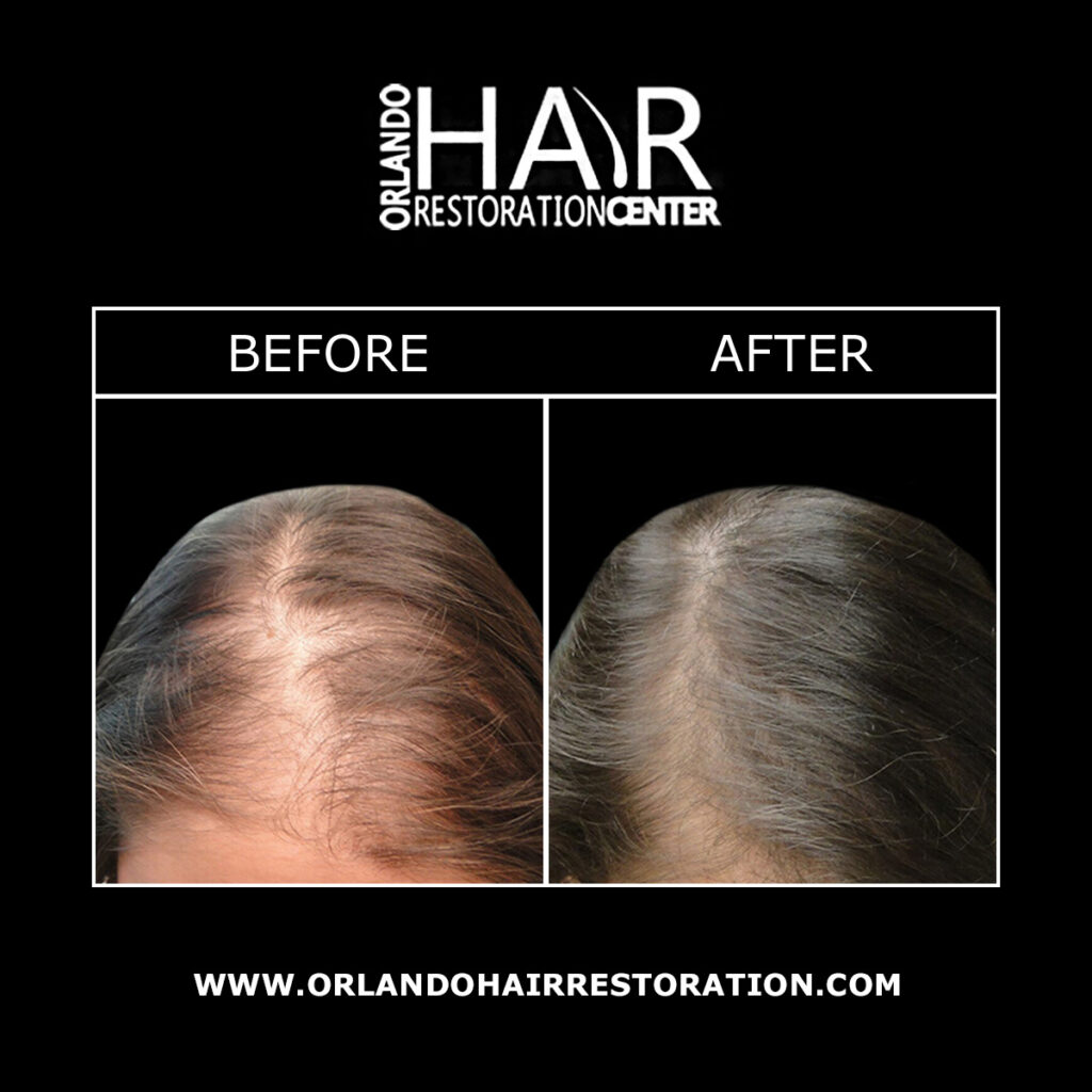Orlando Hair Restoration Center gallery photo