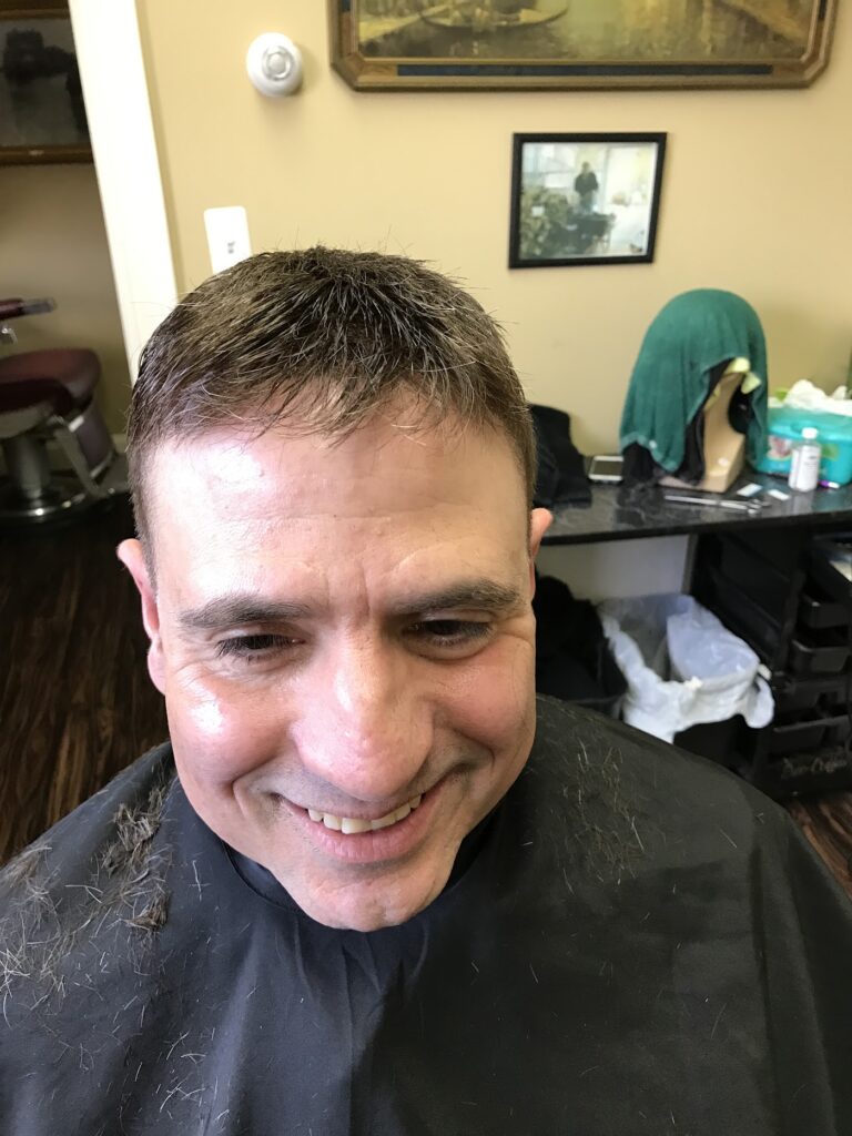 Carmen Christophers Hair Restoration gallery photo