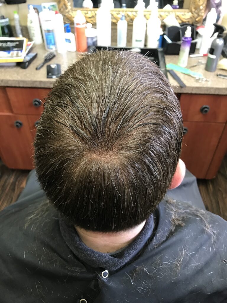 Carmen Christophers Hair Restoration gallery photo