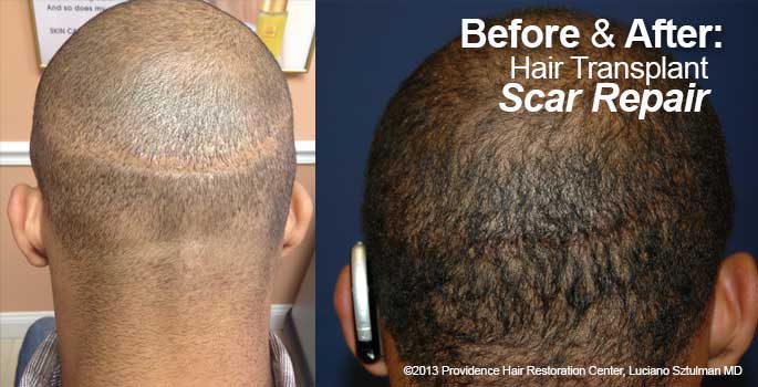 Providence Hair Restoration Center gallery photo