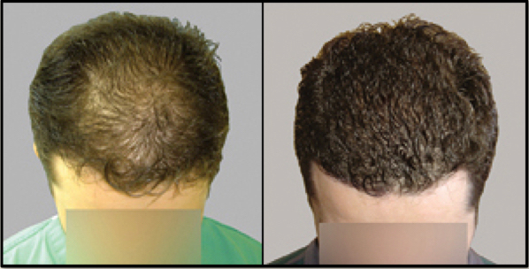 Providence Hair Restoration Center gallery photo